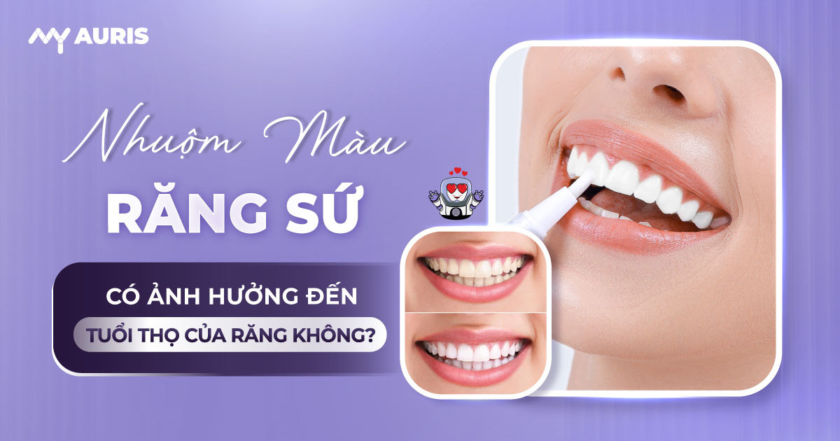 nhuộm màu răng sứ