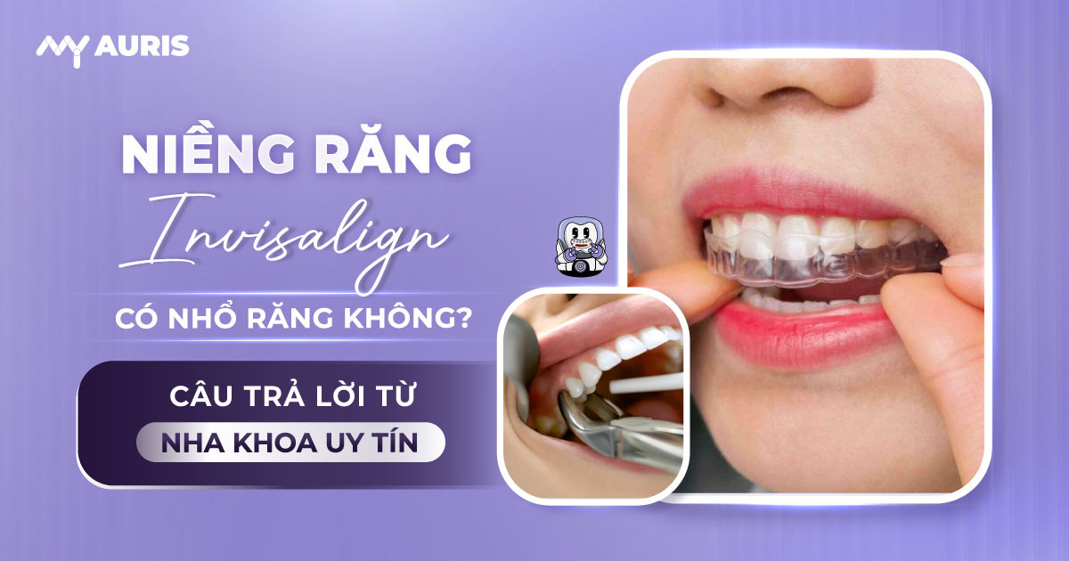 niềng răng invisalign có nhổ răng không,niềng răng trong suốt có cần nhổ răng không