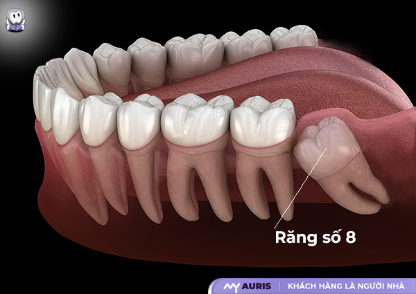 răng số 8,răng số 8 là những răng nào