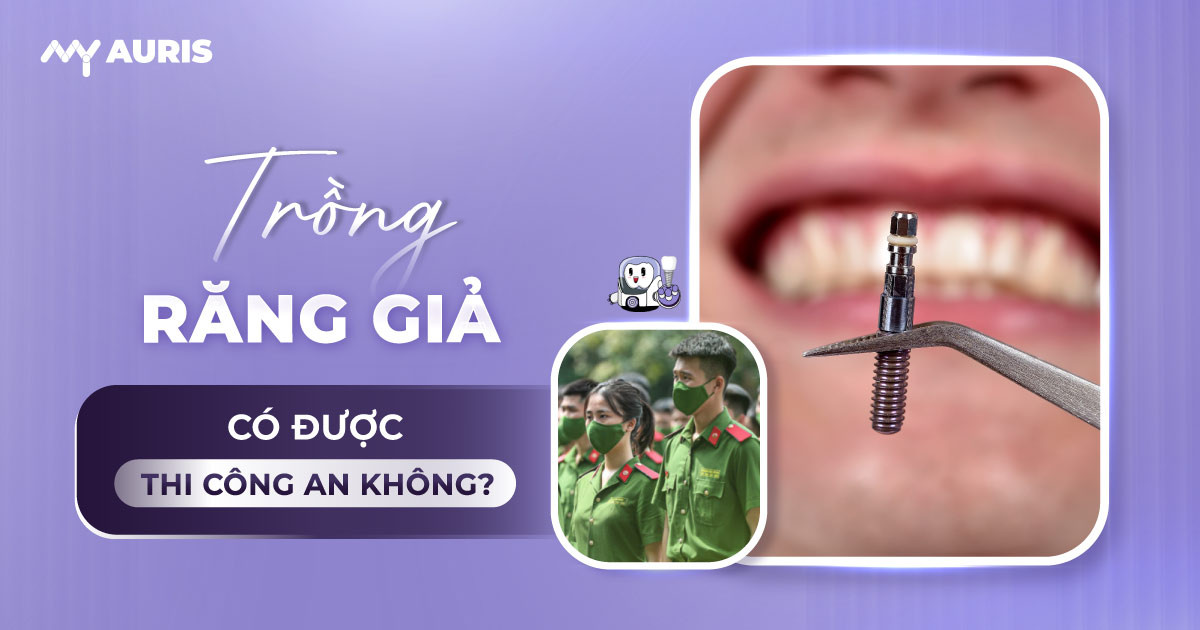 trồng răng có thi công an được không