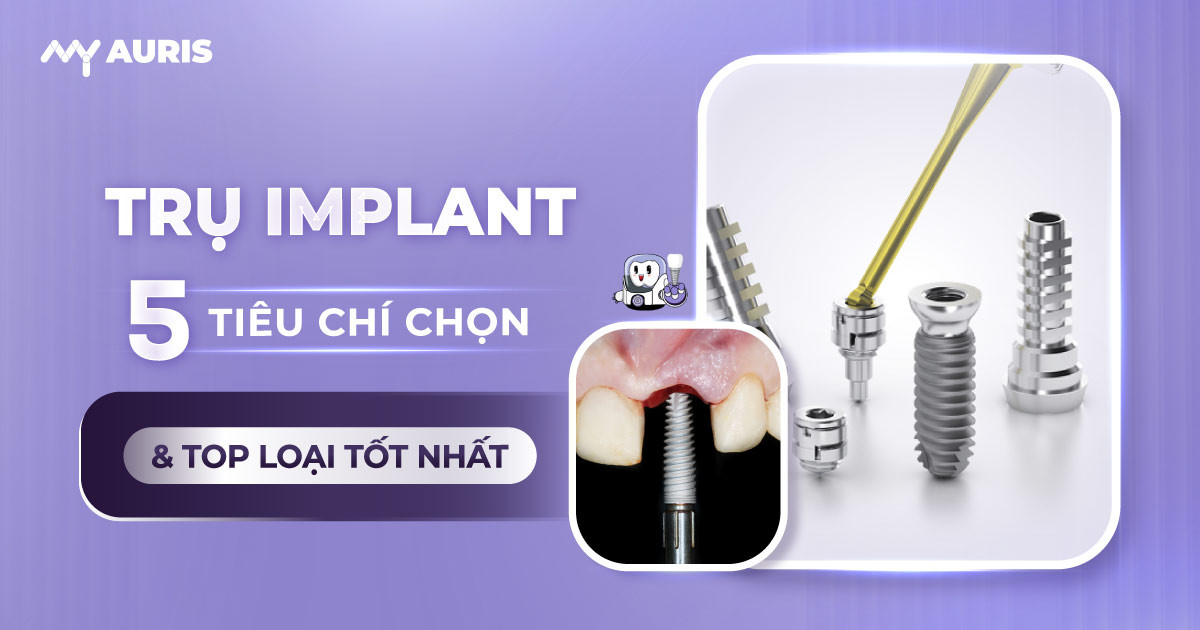trụ implant,các loại trụ implant,implant,kích thước trụ implant,loại vật liệu nào giữ vị trí quan trọng nhất,trụ implant nào tốt