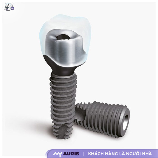 implant hàn quốc có tốt không,trồng răng implant hàn quốc có tốt không