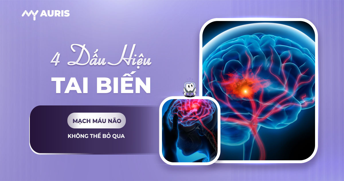 tai biến là gì,4 dấu hiệu tai biến