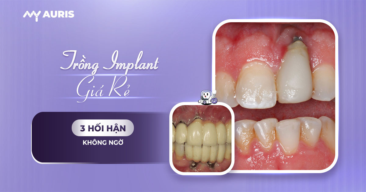 HOI-HAN-TRONG-IMPLANT-090425-01