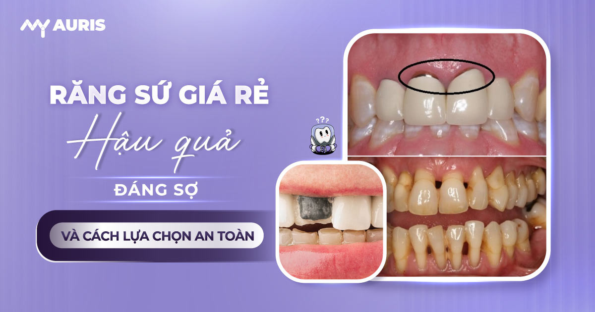 hậu quả bọc răng sứ giá rẻ