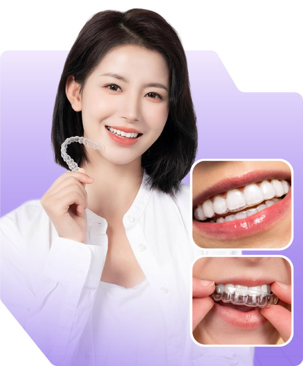 img-nieng-invisalign