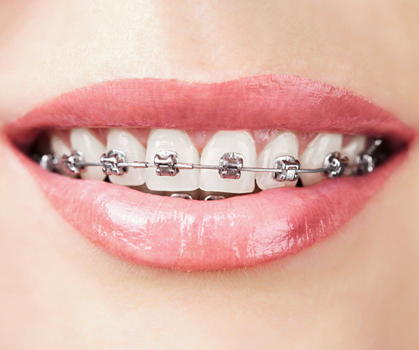 img-nieng-kimloai-tukhoa2