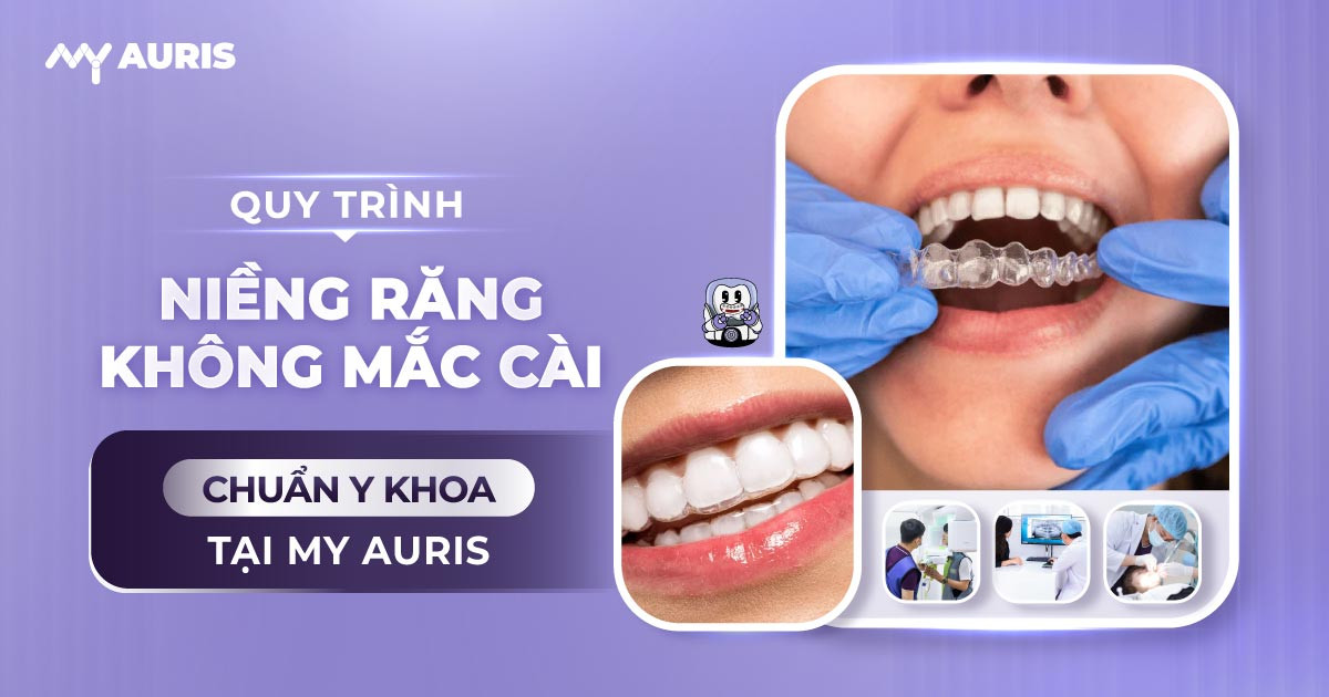 niềng răng không mắc cài