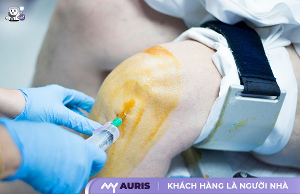 mẹo chữa tràn dịch khớp gối