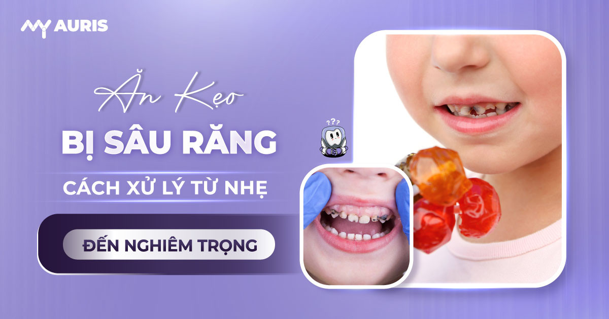 ăn kẹo bị sâu răng,em bé ăn kẹo bị sâu răng