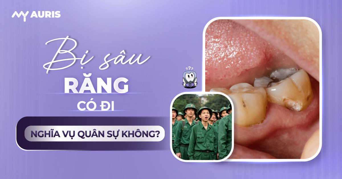 bị sâu răng có đi nghĩa vụ quân sự không