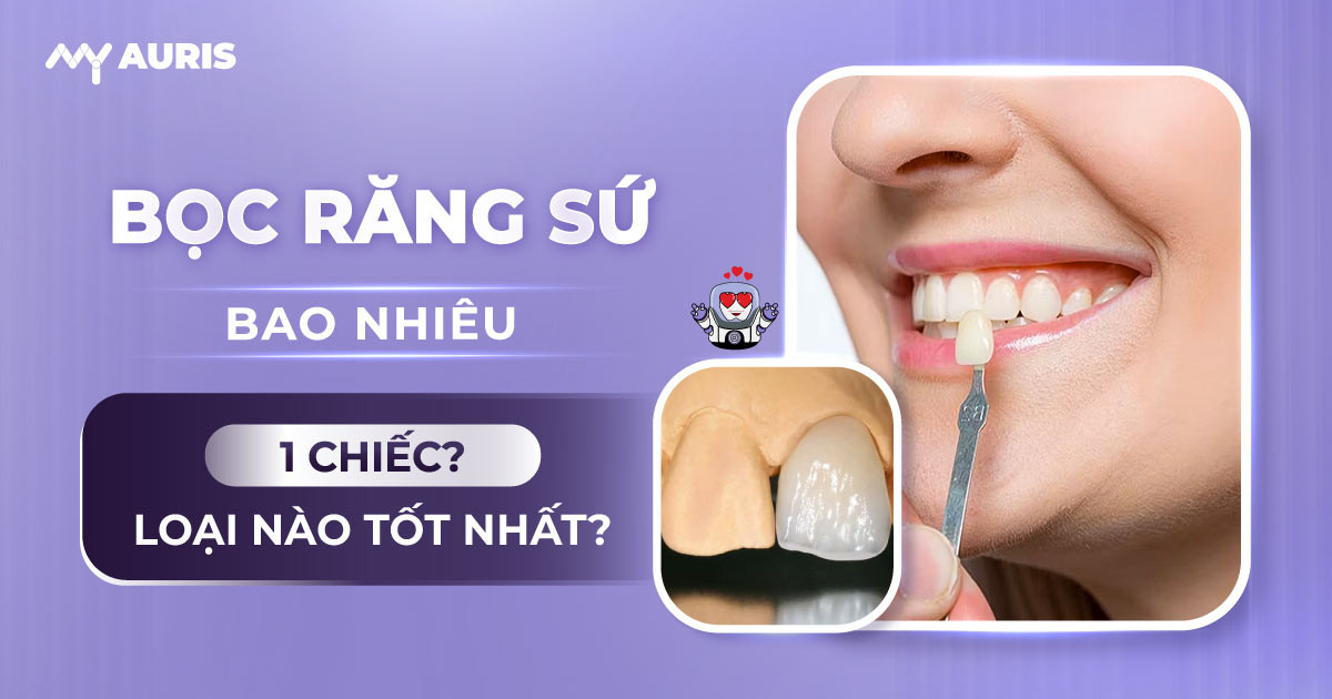 bọc răng sứ bao nhiêu 1 chiếc,răng sứ hết bao nhiêu tiền