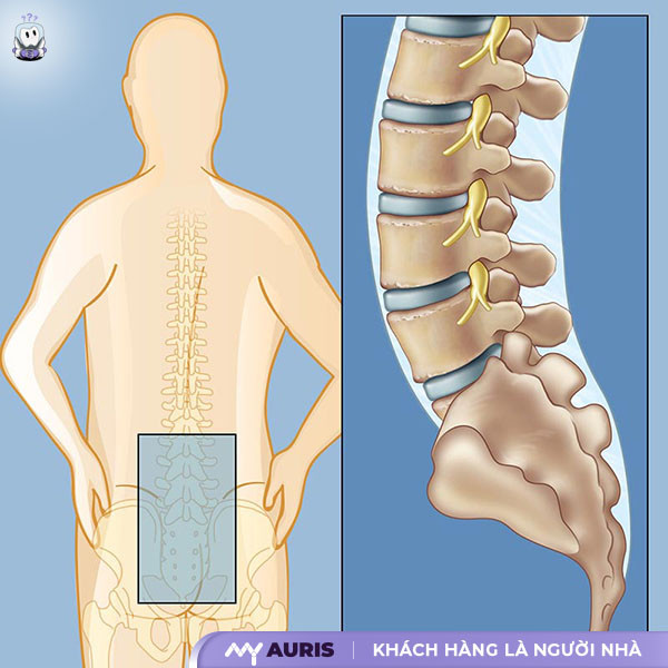 các vị trí đau lưng nguy hiểm