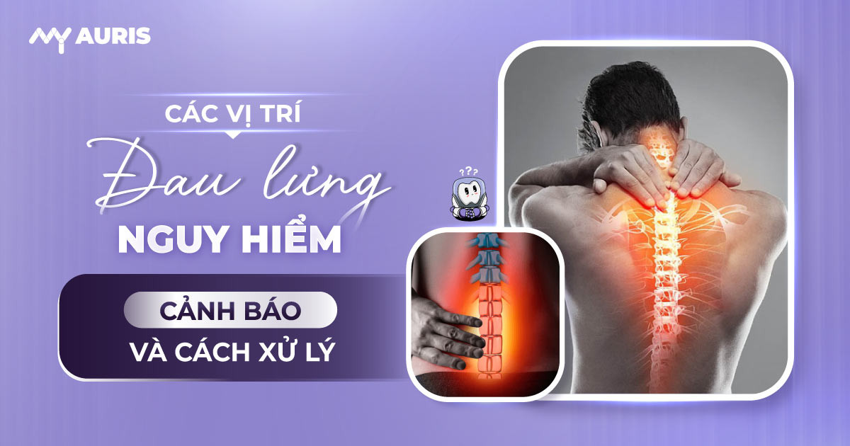 các vị trí đau lưng nguy hiểm