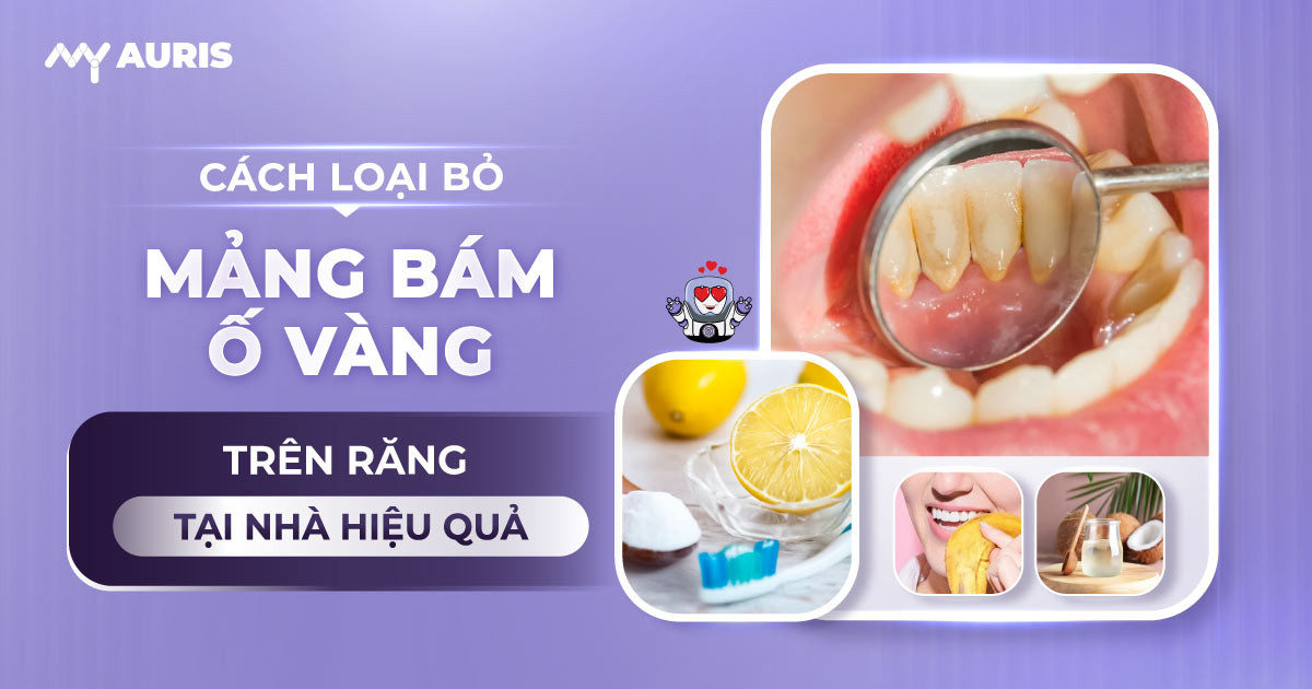 cách loại bỏ mảng bám ố vàng trên răng