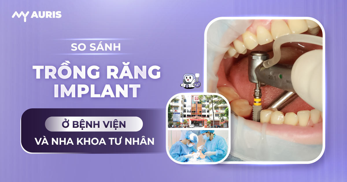 cắm implant bệnh viện răng hàm mặt,bệnh viện có trồng răng không