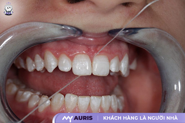 chỉ nha khoa oral b,chỉ nha khoa oral-b,chỉ nha khoa oral b có mấy loại,cách sử dụng chỉ nha khoa oral b