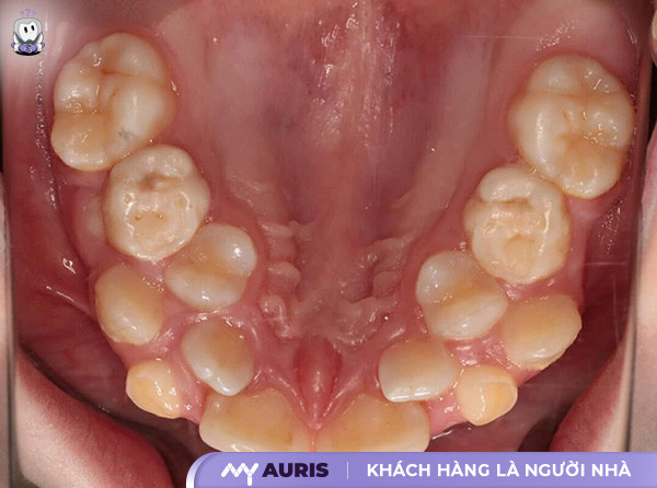 đau răng tiếng anh là gì,đau răng tiếng anh,đau răng trong tiếng anh là gì