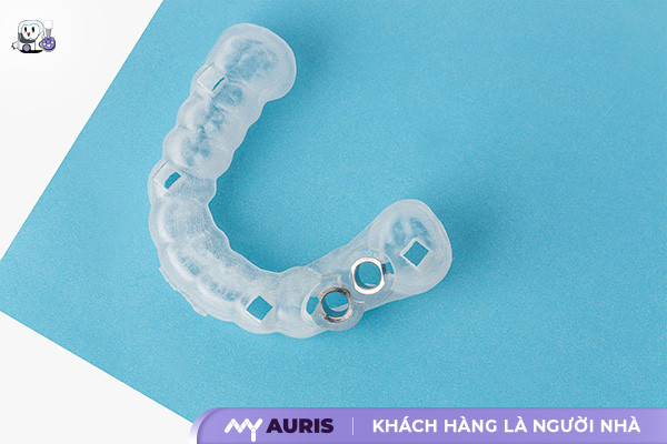 mang-huong-dan-cam-implant-16-5-25-02