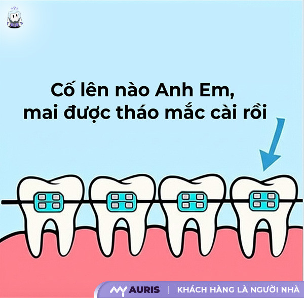 meme niềng răng