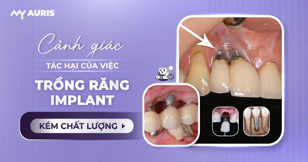 tác hại của việc trồng răng implant,implant,trồng răng implant,trồng răng implant có an toàn không,cấy răng implant có ảnh hưởng gì không,tác dụng phụ của trồng răng implant,tác hại của trồng răng giả,tác hại của trồng răng implant,trồng răng implant có tác dụng phụ không