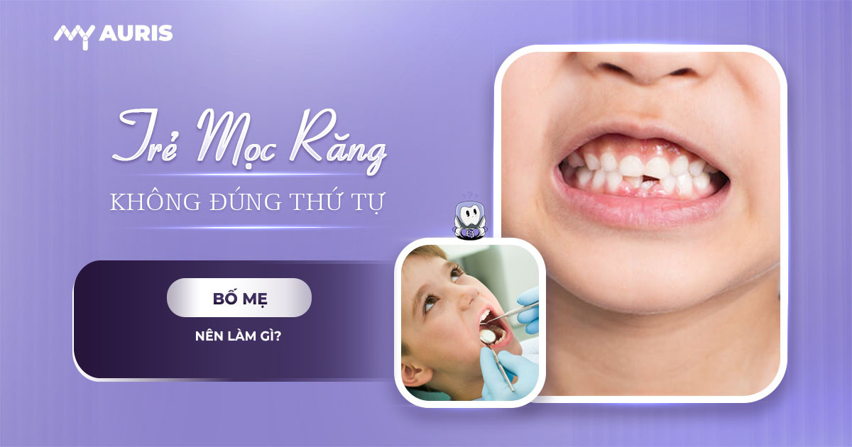 trẻ mọc răng không đúng thứ tự