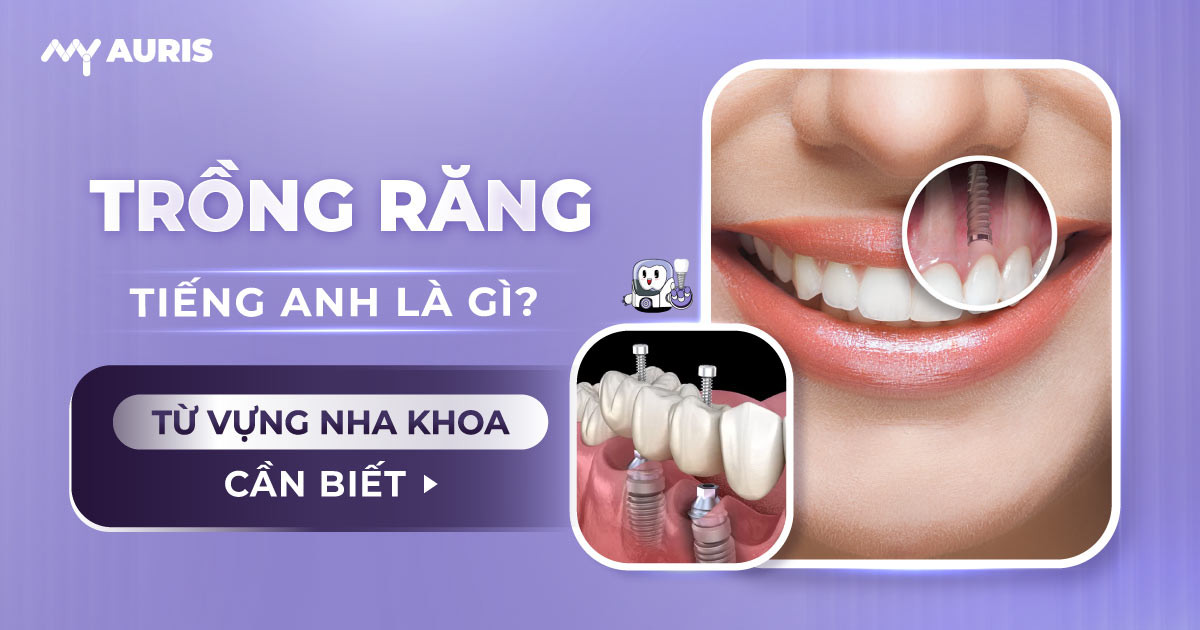 trồng răng tiếng anh là gì,implant tiếng anh là gì ,implant nghĩa là gì,5 câu ghép tiếng anh