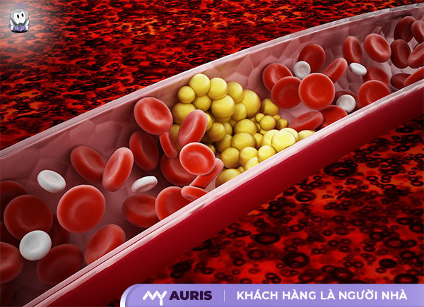uống gì để giảm triglyceride