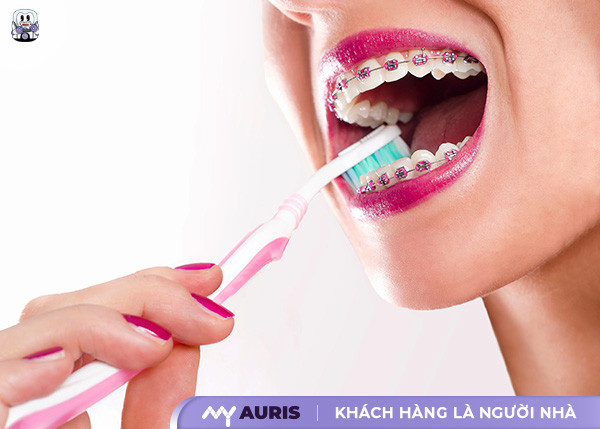 bàn chải niềng răng,bàn chải cho người niềng răng,bàn chải niềng răng lông mềm curaprox cs 5460,niềng răng dùng bàn chải gì,đầu bàn chải điện oral b cho răng niềng