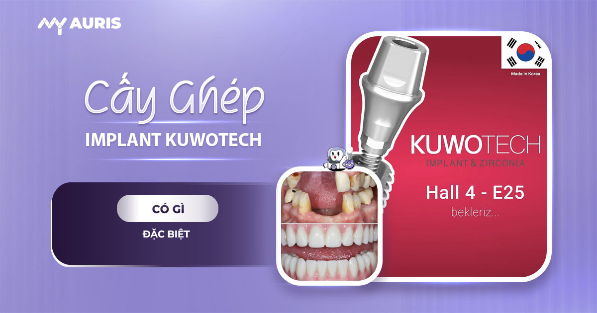 implant kuwotech,trụ implant kuwotech