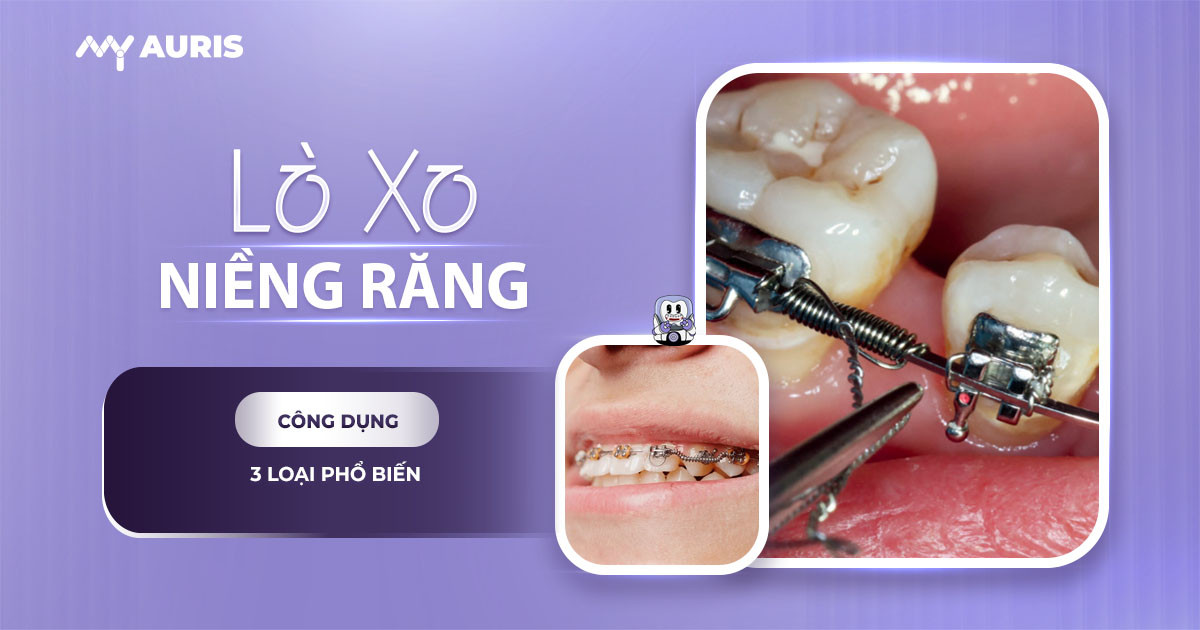 lò xo niềng răng,lò xo đẩy răng