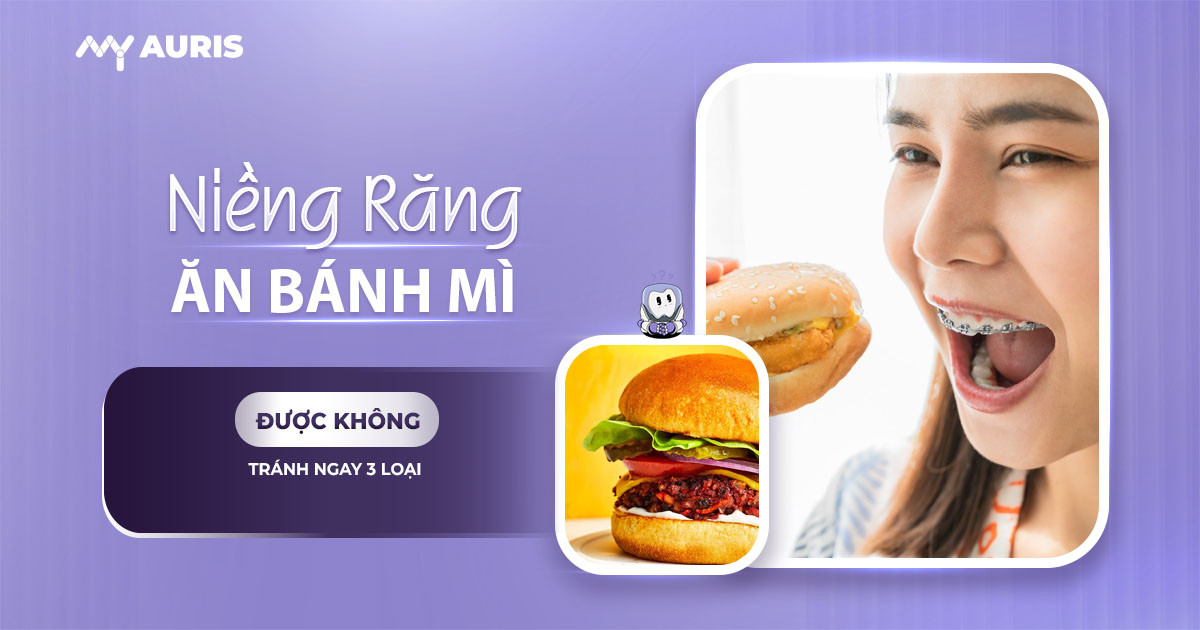 niềng răng ăn bánh mì được không
