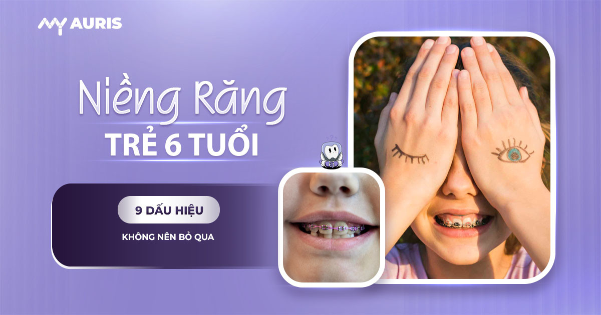 niềng răng cho bé 6 tuổi,niềng răng cho be 6 tuổi