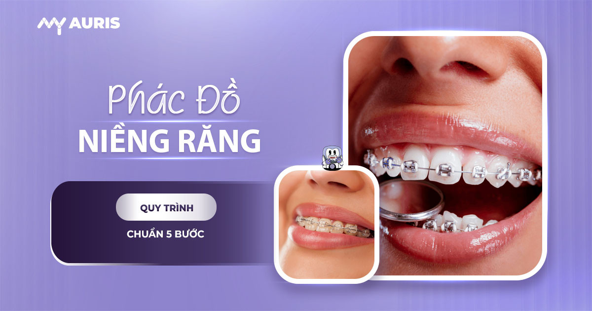 phác đồ niềng răng là gì