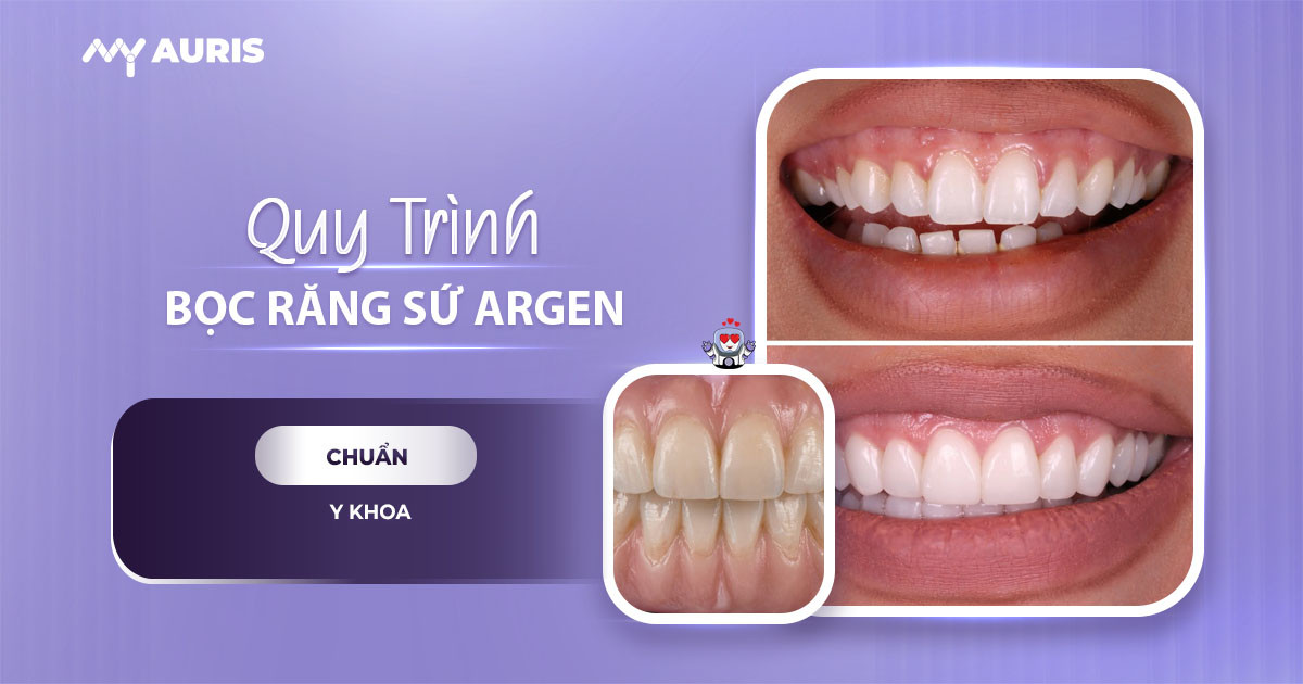 răng sứ argen, bọc răng sứ argen