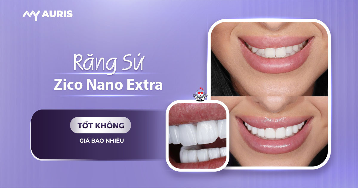 rang-su-zico-nano-extra-050625-01