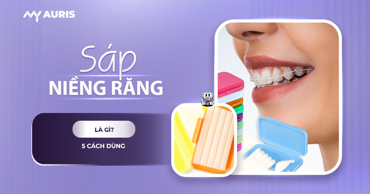 sáp nha khoa niềng răng,sáp nha khoa,sáp chỉnh nha,cách dùng sáp nha khoa,cách sử dụng sáp nha khoa