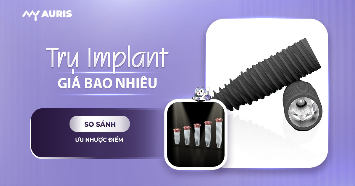 implant kontact giá bao nhiêu,implant kontact pháp