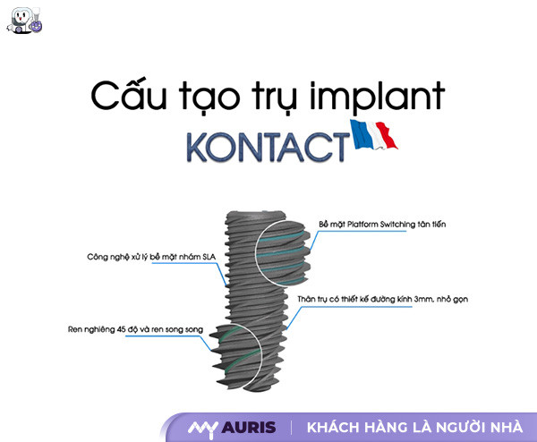 implant kontact giá bao nhiêu,implant kontact pháp