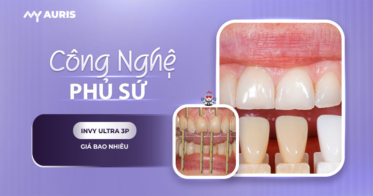 công nghệ phủ răng sứ invy ultra 3p