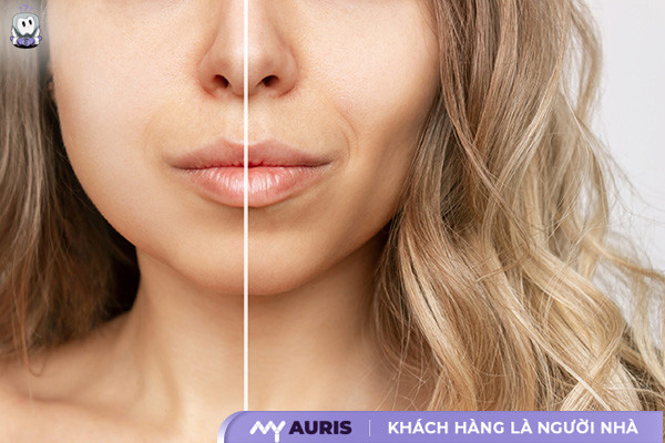 gò má cao,gò má cao là như thế nào,phụ nữ gò má cao,gò má cao thì sao,gò má cao có đẹp không,lưỡng quyền là gì