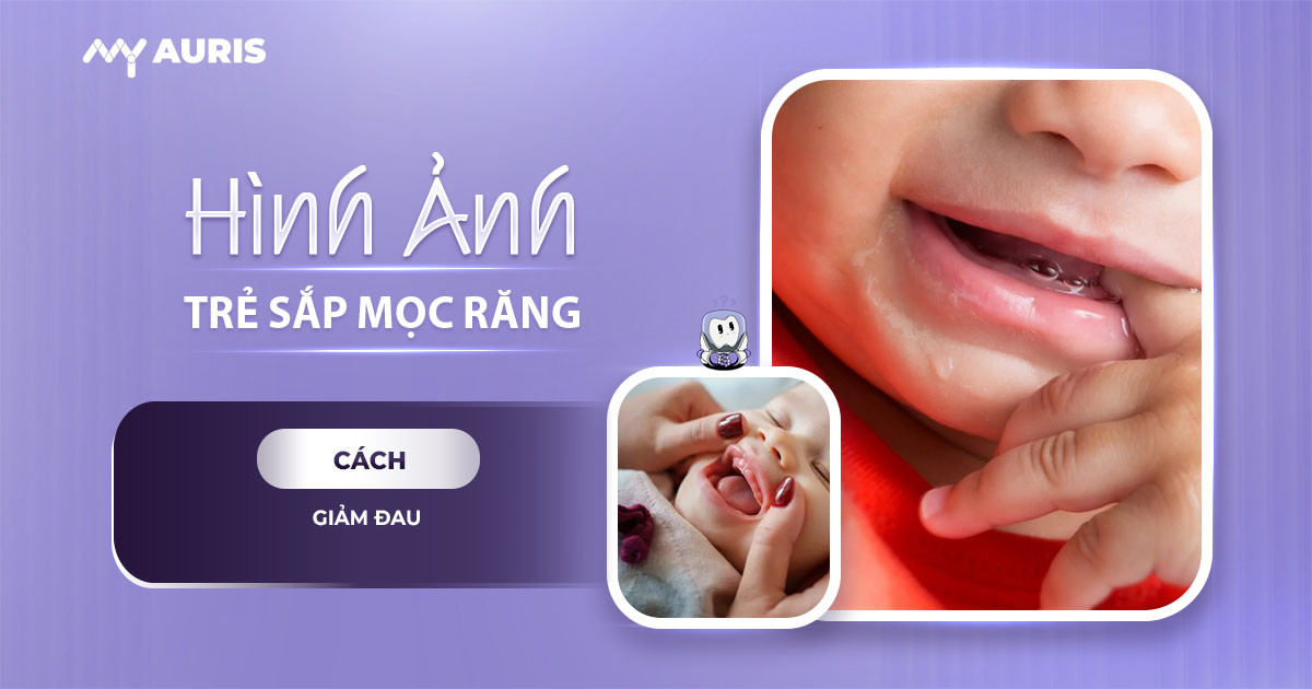 hình ảnh lợi trẻ sắp mọc răng cửa,hình ảnh lợi trẻ sắp mọc răng của,hình ảnh bé sắp mọc răng,hình ảnh lợi trẻ sắp mọc răng