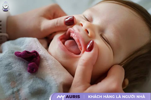 hình ảnh lợi trẻ sắp mọc răng cửa,hình ảnh lợi trẻ sắp mọc răng của,hình ảnh bé sắp mọc răng,hình ảnh lợi trẻ sắp mọc răng