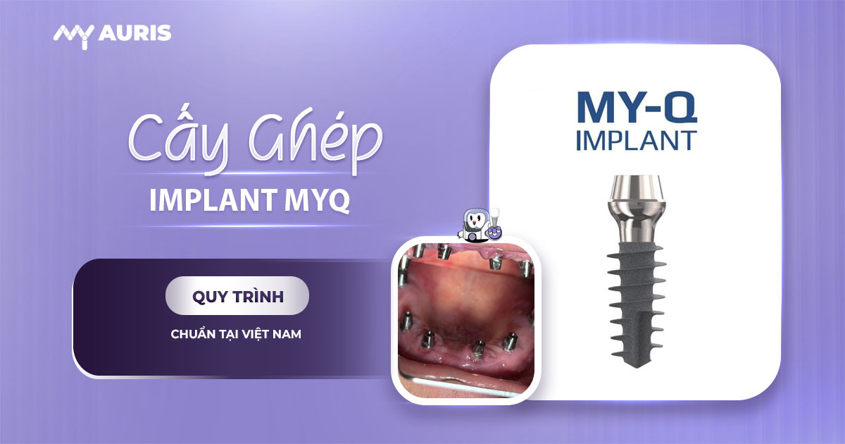 implant myq