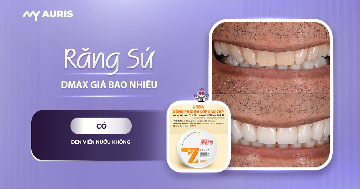 răng sứ dmax