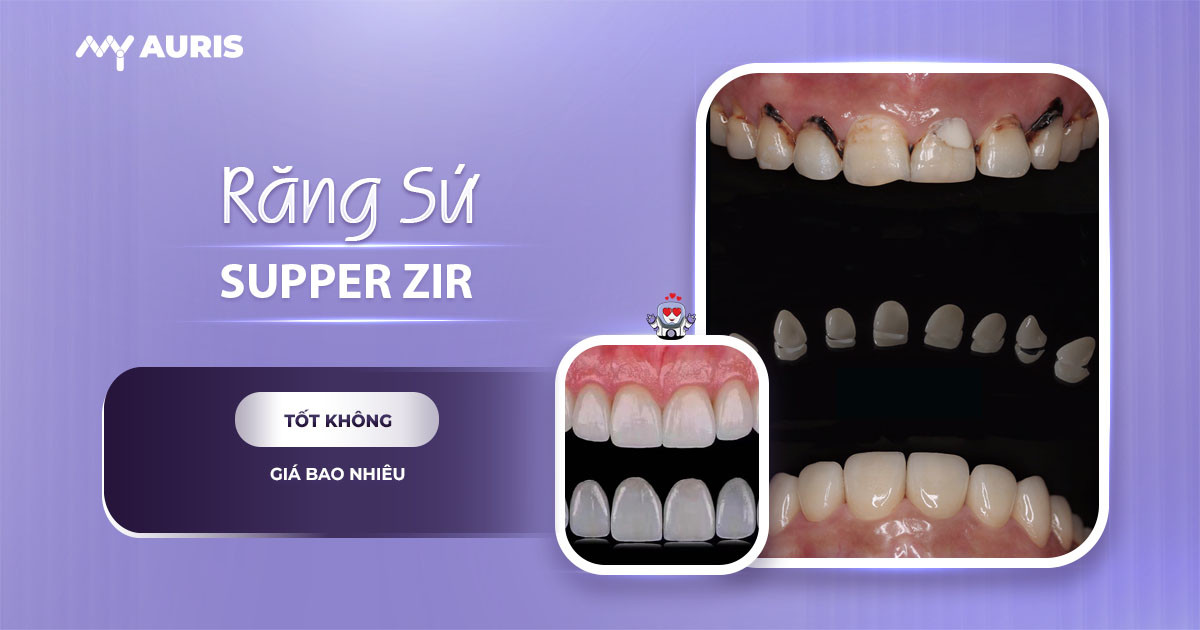 Răng sứ Super Zir