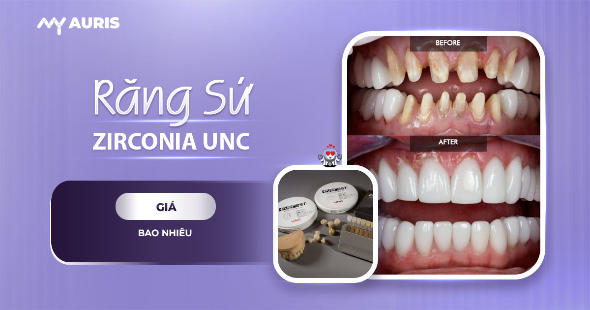 zirconia unc,răng sứ zirconia unc