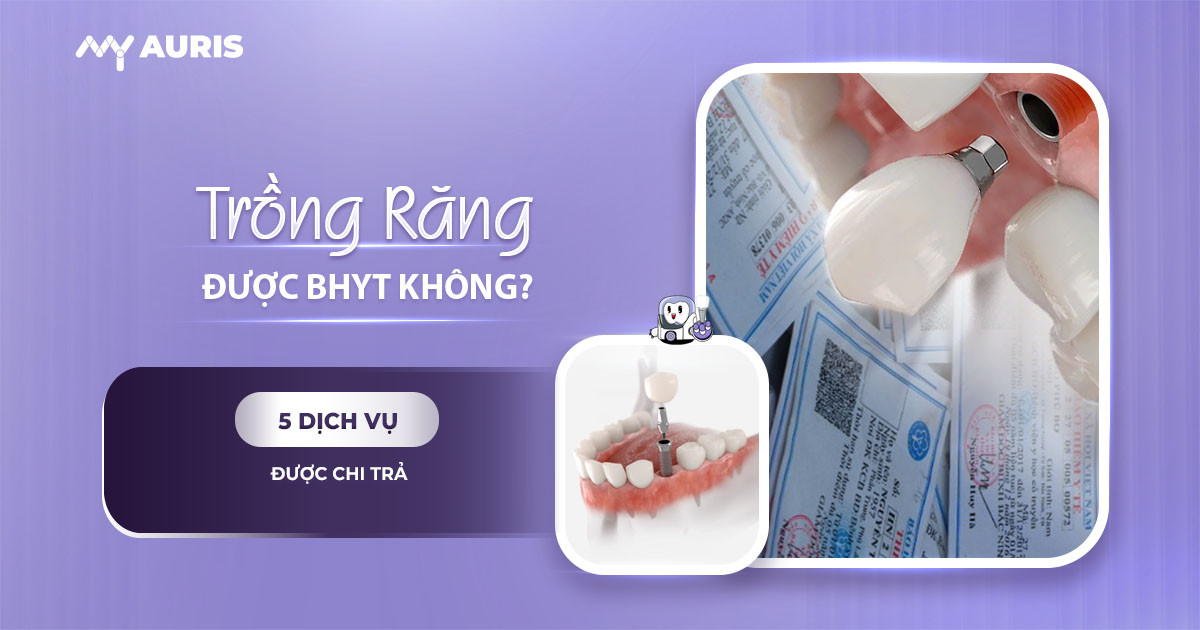 trồng răng có được hưởng bảo hiểm y tế không