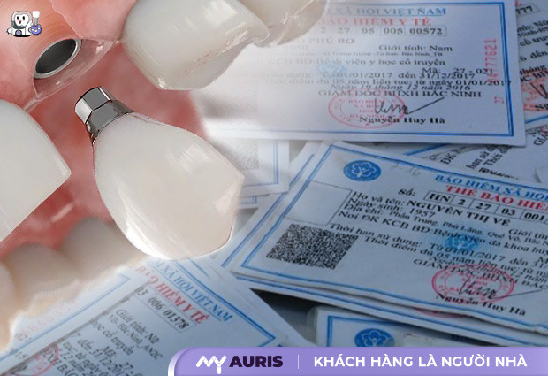 trồng răng có được hưởng bảo hiểm y tế không