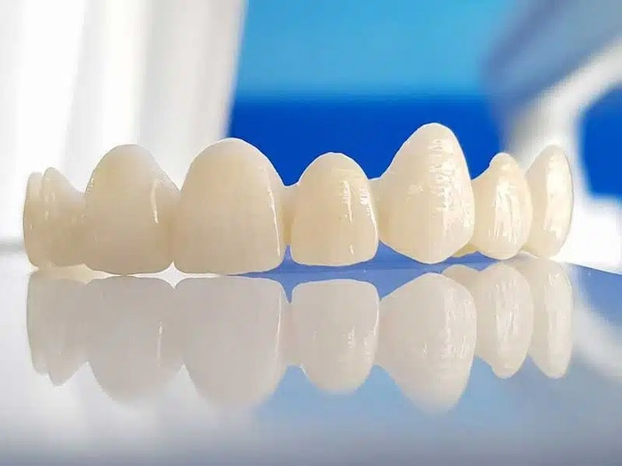 1 bộ răng sứ bao nhiêu tiền